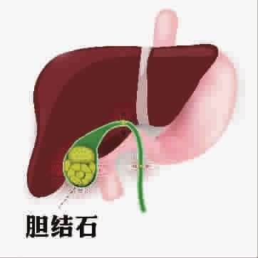 p1_b.jpg