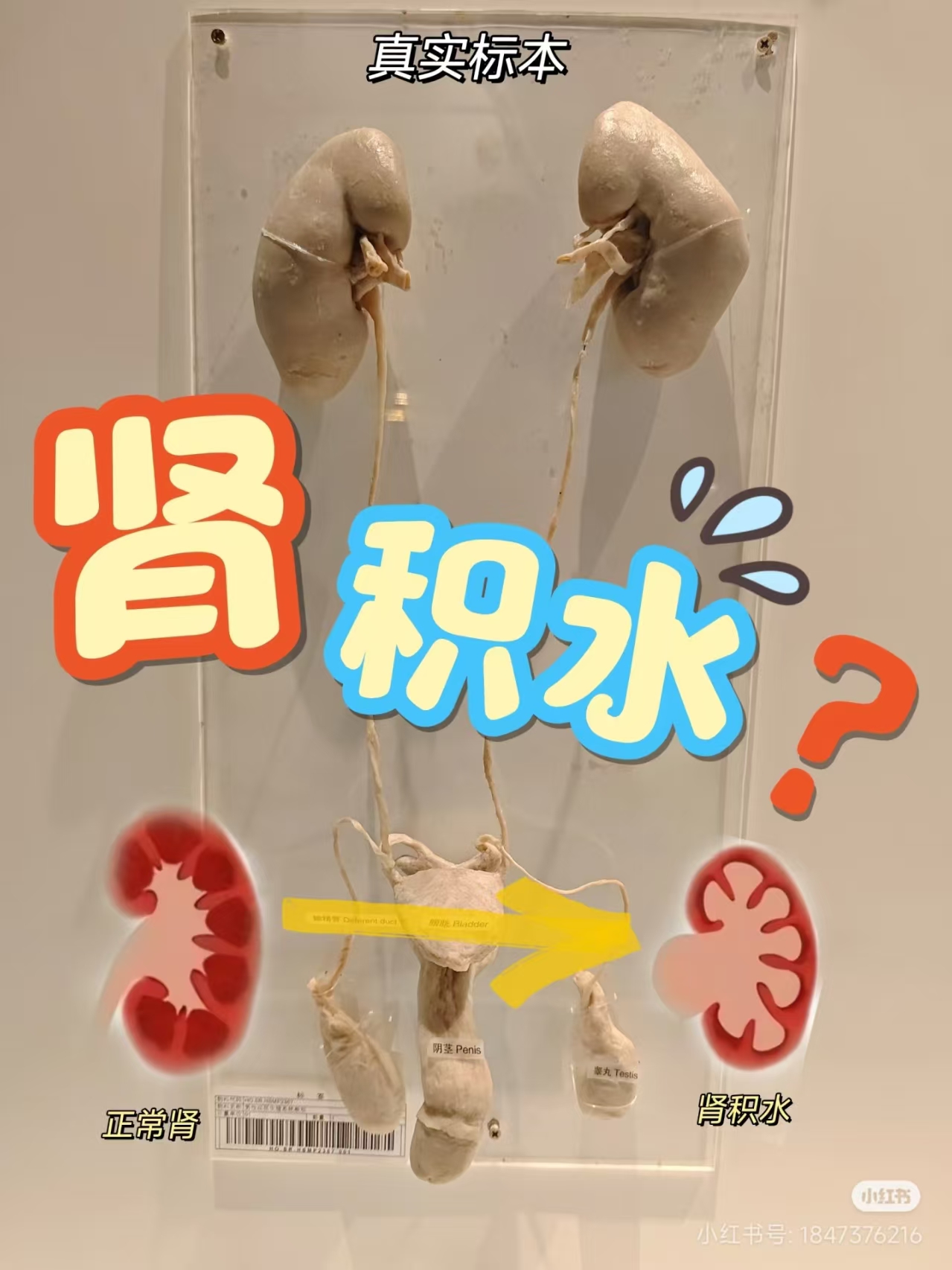 8ea4b246e0591bcaee3d31cada413cf.jpg